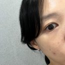 태평역에스테틱 아마로스 - 광고XX 내돈내산 10년단골 성남여드름관리 후기 신흥동피부관리 찐추천