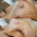 여수 마사지샵 건강미스킨앤바디 아쿠아필 오메가PDT 관리 받고 온 후기