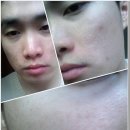 닥터 이아소