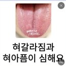 혀가 이렇게 깨끗하고 맨들할 수가 있어?? 이게 보통 사람들의 혀 상태야?? 이미지