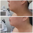 문스킨케어 이미지