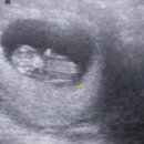 까망 곰 젤리 이미지