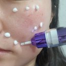 호호톡스 | 알프랩 엑소베녹신 뱀톡스 크림 내돈내산 사용후기 주름, 탄력관리에 좋아요