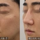 르씨엘의원 이미지