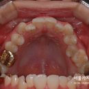 가지런이치과교정과의원 이미지