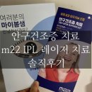 검사 및 치료] 마이봄샘 적외선 촬영, IPL/M22 레이저 치료 1, 2, 3회차 솔직 후기, 치료 통증, 가격