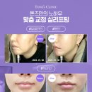 톤즈의원인천 네이버블로그