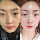 아르베라