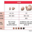 엔트라