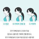 코쿠너 | 경추베개 추천! 코쿠너 일주일 사용 후기 (거북목 개선 느낌 솔직 리뷰)