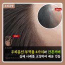 스페셜티 스튜디오(Specialty Studio) | 두피문신 부작용 4가지와 잔흔커버, 실패 사례를 교정하며 배운 것들 (분당 두피공방)