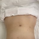 에스더 | 명일동 피부관리 복부 다이어트 미앤쿨쿨핏 내돈내산 후기 에스더스킨앤바디