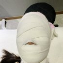 [포항피부관리] ”인디자인페이스“ 카복시테라피 후기