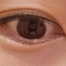 권안과의원 이미지