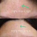 탈리타쿰 | 탈리타쿰 화이트 단델리온 에센스 수 30일 각질부자 실사용 후기