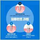 지구치과기공소 이미지