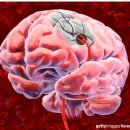 정상적인 뇌의 혈관 벽은 1,500㎜Hg라는 높은 혈압에도 견디는 탄력성과 유연성을 가지고 있다 이미지