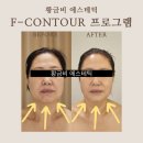 개금성원상떼뷰오피스텔 | 개금피부관리 일년에 단 한번! 인생미인 뷰티 페스티벌