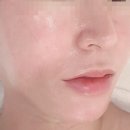 유니나 피부관리
