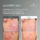수블리야