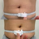 보보스빌딩 | [뷰티] 창원피부관리, 아드딸뷰티 복부 미레브 관리후기