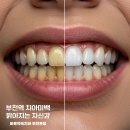소사구 경인로 56 | 부천역 치아미백 :: 밝아지는 자신감