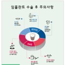 부천상동치과, 임플란트 수술 고민하고 계신가요?