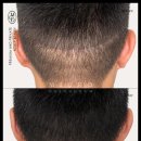 탈모왕 본점 이미지