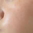 쥬 | 청담 피부과 압구정로데오 포텐쥬(포텐자+쥬베룩) 내돈내산 후기