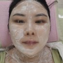 굿페이스의원 네이버블로그