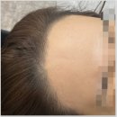 추라인뷰티 이미지