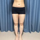 수연의원 | 대전 비만클리닉의원 하프하게 요요없는 지방분해주사 다이어트 성공후기(feat.최종몸매사진)