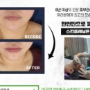 수피부