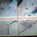 태광메디칼 이미지