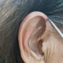 시그니아독일보청기대구북구센터 이미지