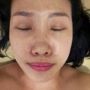 부산 강서구 명지동 피부관리맛집 : 타임에스테틱 멜라소닉 관리 후기