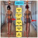 내방체육관(올바른 체형) | 동래 온천동 체형교정, 한달 후 보행+자세교정 비포에프터 변화