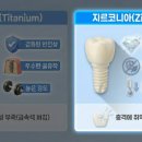 상아치과재료 이미지