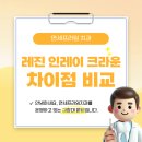 프라임치과기공소 | 마송 치과 충치 레진 인레이 크라운 차이점과 단계별 치료