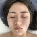 평택 고덕 1:1 맞춤 피부관리! 희다에스테틱 물방울리프팅 솔직 후기