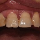 건치치과기공소 이미지