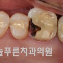 네츄럴치과기공소 이미지