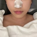 광교피부관리 루비엔에스테틱 진정필 받고온 후기