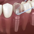 휴플란트치과의원 이미지