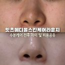 올메디 - 중구 | 🌿[창원 피부관리 추천] 잇츠메디올스킨케어라운지ㅣ수분보충케어 후기, 홍조·트러블 피부관리