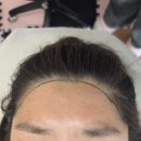 [수원헤어라인 추천] 인계동아르지아 가루헤어라인 후기