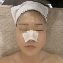 검단 피부관리 아라동 에스테틱 ‘더맑은스킨 인천검단신도시점’ 화이트태닝 솔직후기