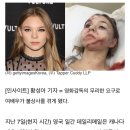 "더 세게 때려라" 영화감독 때문에 부상당해 얼굴 70바늘 꿰맨 여배우 (상처사진주의) 이미지