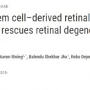 美 NIH, 역분화줄기세포로 AMD 치료 가능성 확인 이미지