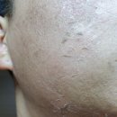 천안 RPC 이미지